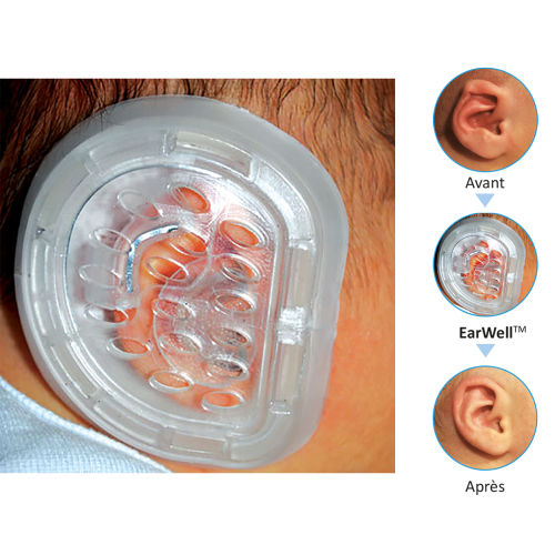 EarWell kit de démarrage (2x6 conformateurs moyens + 2x6 larges)