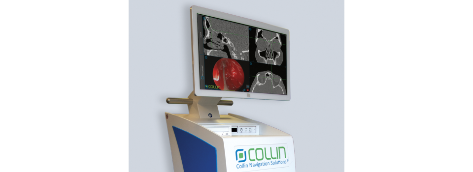 ENT Surgical Navigation System